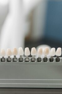 Dental Veneers - Porcelain Veneers Dentist in South Reno, West Reno, Damone Ranch, NV