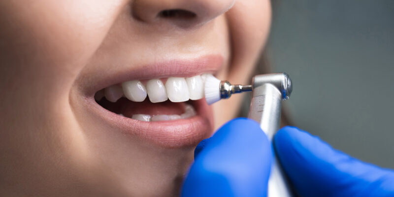 dental cleaning