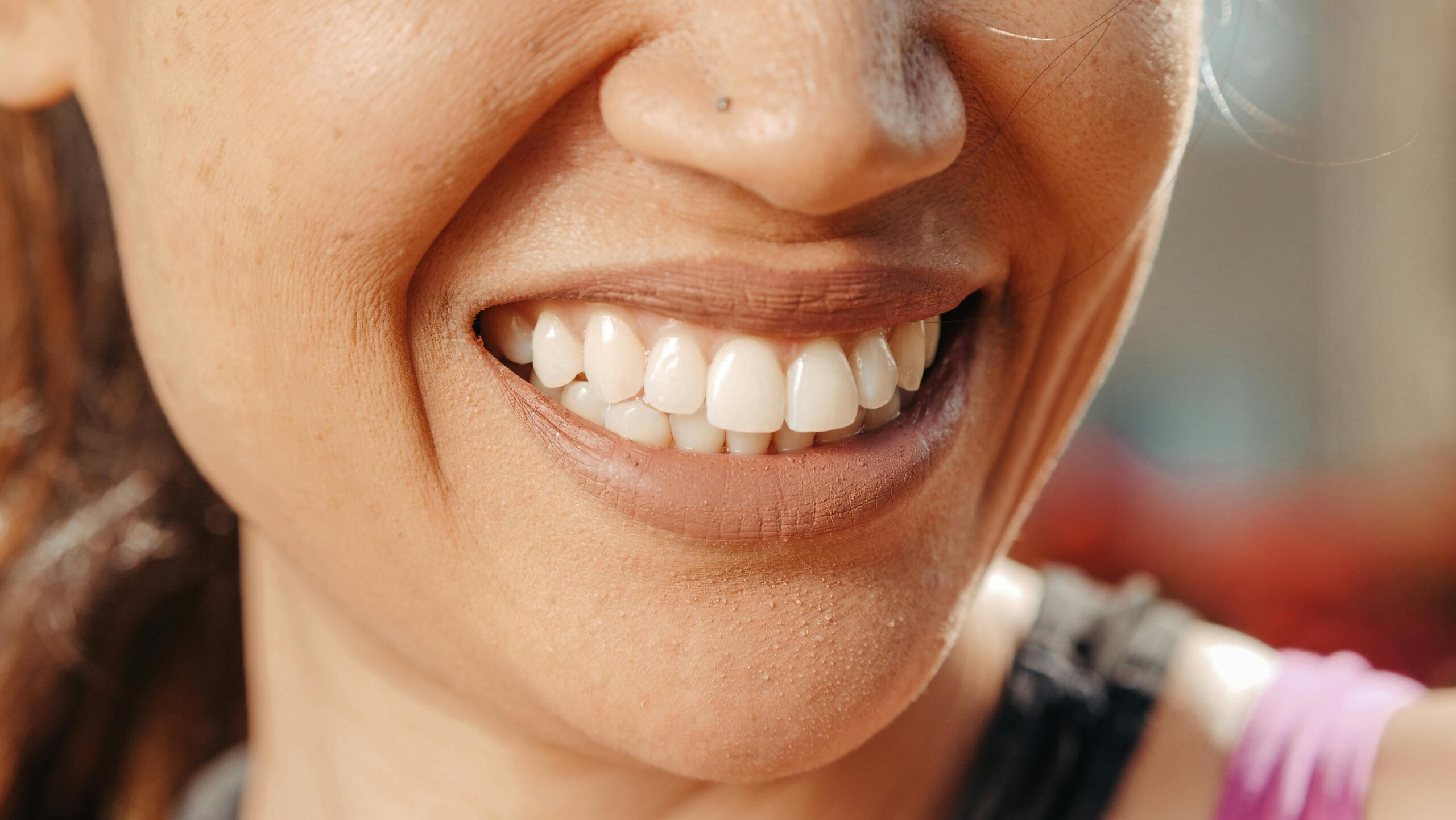 Close Up Photo of Persons Smile scaled - Elite Dental Aesthetics
