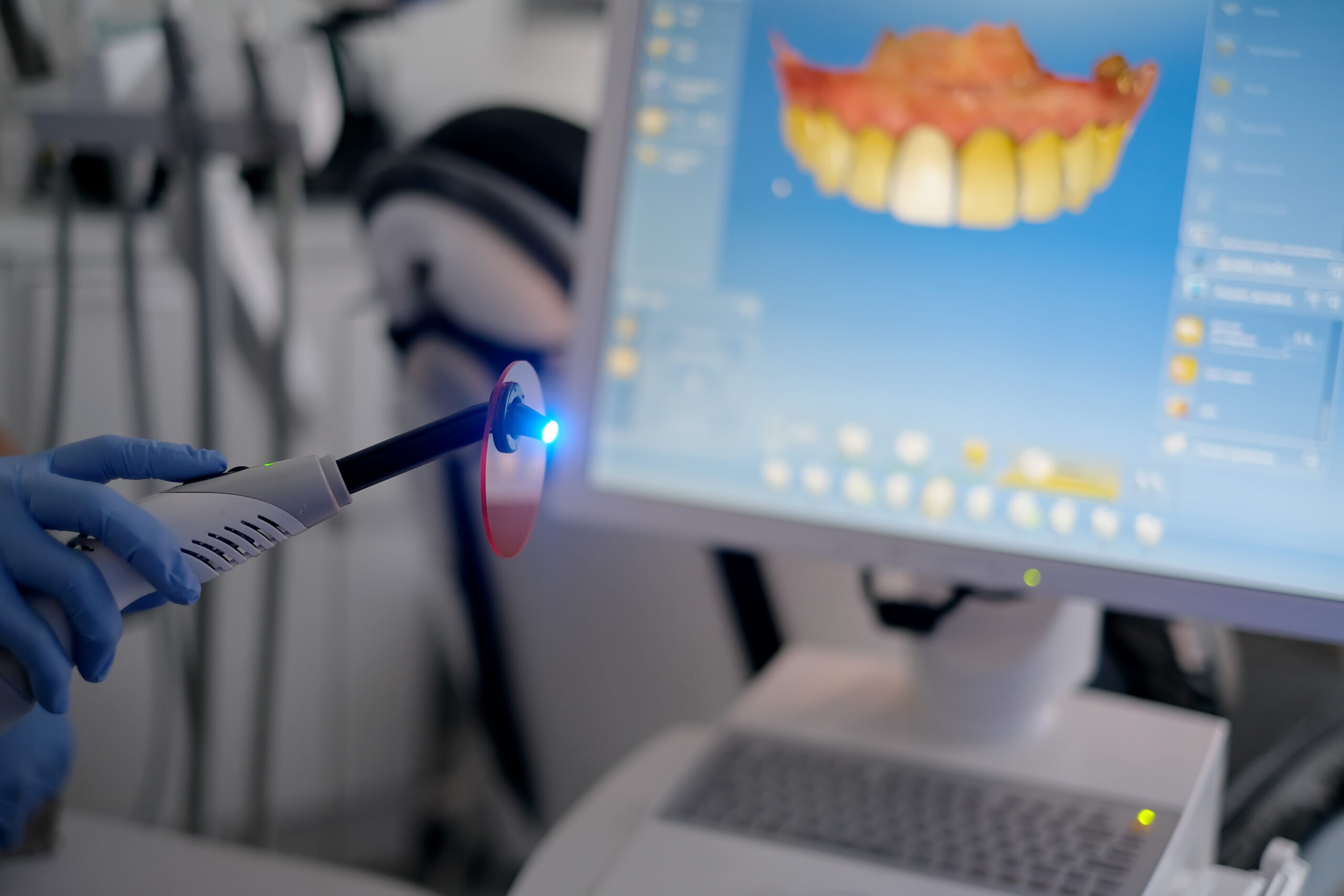 Dental curing UV light on Monitor background. High quality photo